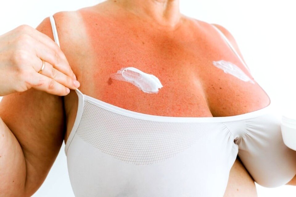 Femme avec une poitrine rouge